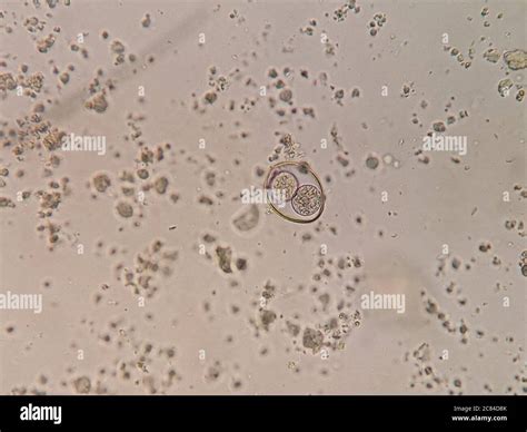  Isospora: Unleashing Microscopic Mayhem - An In-depth Look at These Sneaky Intestinal Parasites!