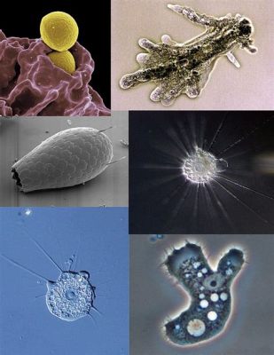  Technosphaeridium! This Amoeboid Genus Exhibits Remarkable Flexibility and Locomotion Strategies